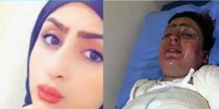  عراقية تضرم النار بنفسها أمام زوجها