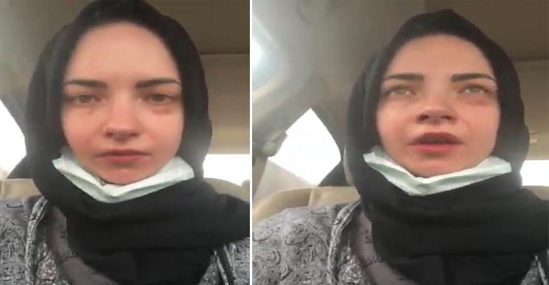 روسية تتعرض للتعنيف من زوجها السعودي
