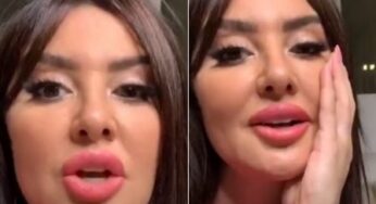 الفنانة المغربية ميساء مغربي تتعرض لموقف محرج على الهواء.. (شاهد بالفيديو) كيف ردت على منتقدي شفتيها!