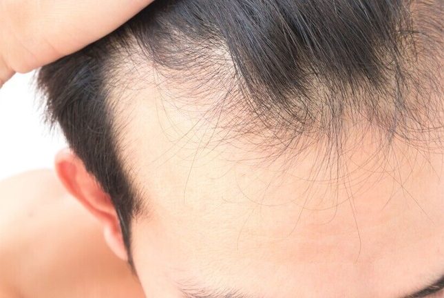‏مستخلص طبيعي يزيد من نمو الشعر
