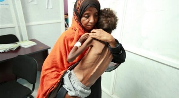 الأمم المتحدة: الجوع ينتظر نصف سكان اليمن العام المقبل