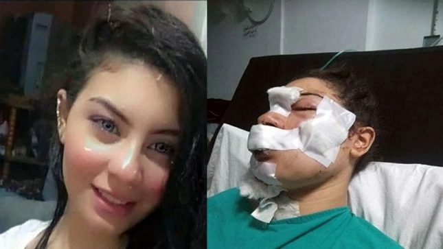 زوج المصرية “إسراء عماد” يفجر مفاجأة في قضية تشويه وجهها بـ”سكين”.. وعلاقتها بصديقه
