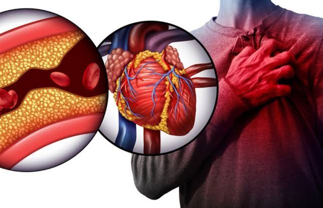 عادة واحدة يمكنها خفض الكوليسترول في الدم بعد سن الـ 50
